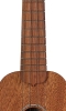 Neck